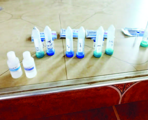 Lateral flow devices, centrifuge tubes and solvent buffers for rapid extraction of aflatoxins Image